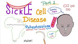 What is Sickle Cell  Animation [upl. by Eerak741]