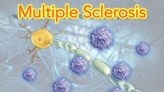 How to Diagnose Multiple Sclerosis In 5 steps [upl. by Wickner]