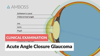 Neuroblastoma Osmosis Study Video [upl. by Dlaregztif]