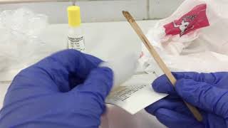 MT Laboratory Procedures  MT 35 Fecal Occult Blood Test HemaScreen [upl. by Shargel]