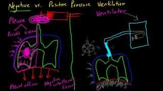 Negative vs Positive Pressure Ventilation [upl. by Thormora]