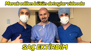 vLog Saç ektirdim  Bütün detaylarıyla saç ekimi nasıl yapılır bu videoda [upl. by Reece]