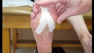 Teardrop Arch Taping for Plantar Fasciitis [upl. by Anirav498]