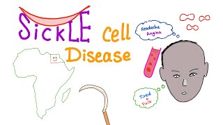 How to Use Sickle Scalers [upl. by Aylatan]