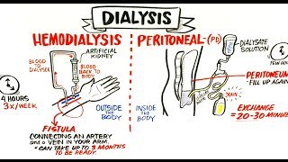 Failing Kidneys and Different Treatment Options [upl. by Owen]