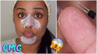 DIY Pore Strips Get Rid of BlackheadsWhiteheads  EASY [upl. by Euqinim]