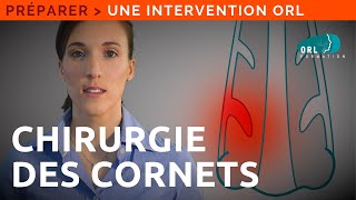 Information Patient  Chirurgie des cornets turbinoplastie [upl. by Anohr]