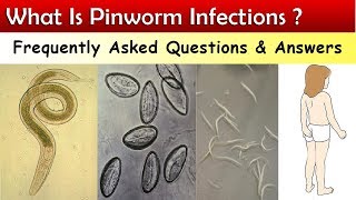 What Is Pinworm Infections   FAQ amp Answers [upl. by Delmor]