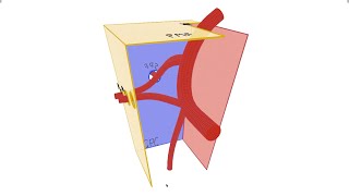 Pterygopalatine Fossa  Anatomy Contents and Borders [upl. by Sualakcin]