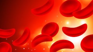 Sickle Cell Anemia [upl. by Kathryn51]