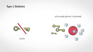 Short and easy to understand What happens in diabetes [upl. by Tootsie]