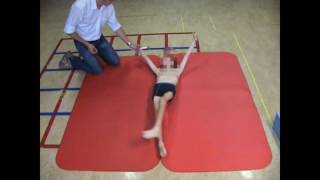 Dyskinetic cerebral palsy case 3 [upl. by Hofstetter]