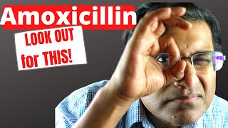 What is Amoxicillin used for 12 valuable TIPS [upl. by Telimay]