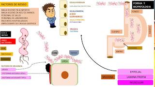 Helicobacter PYLORI duodenitis [upl. by Xxam]