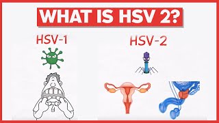 What is HSV 2 [upl. by Rubetta908]