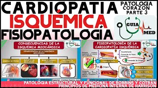 CARDIOPATÍA ISQUÉMICA FISIOPATOLOGÍA  GuiaMed [upl. by Amliw]