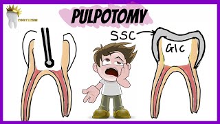 PEDIATRIC DENTISTRY  PULPOTOMY  Types Indications Procedure [upl. by Lightfoot603]