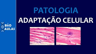 Adaptação Celular Hipertrofia Hiperplasia Hipotrofia Metaplasia Patologia Geral  Bio Aulas [upl. by Hasheem]