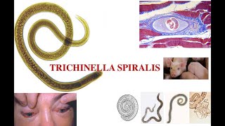 Triquinella spiralis [upl. by Esened]