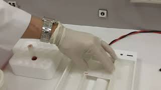 Hemoglobin Electrophoresis using Helena method [upl. by Ardnikal]