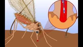 Leishmaniasis life cycle [upl. by Weider652]