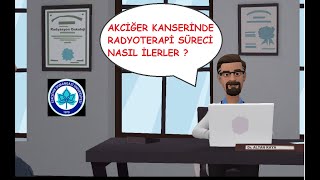 AKCİĞER KANSERİNDE RADYOTERAPİ SÜRECİ NASIL İLERLER [upl. by Kaliope]