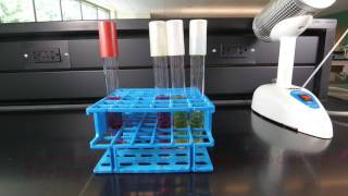 Fermentation of Carbohydrates [upl. by Gabrielle]