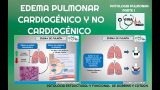 EDEMA PULMONAR CARDIOGÉNICO Y NO CARDIOGÉNICO  GuiaMed [upl. by Zollie962]