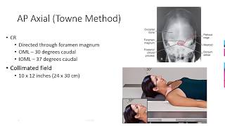 Radiographic Positioning of the Skull [upl. by Akahs]