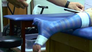 Achilles Tendon Taping [upl. by Ackerley]