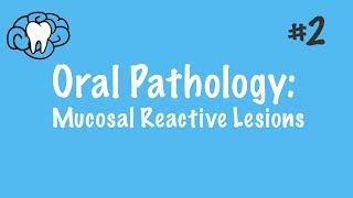 Oral Pathology  Mucosal Reactive Lesions  INBDE ADAT [upl. by Millburn340]