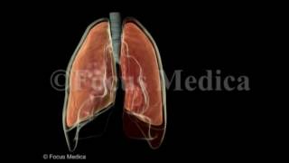 Hemothorax  Lungs [upl. by Yenoh]