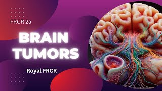 6  Neuroimaging for FRCR [upl. by Ellener730]