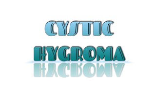 CYSTIC HYGROMA [upl. by Ilario889]