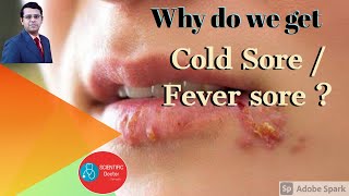 Cold Sores  Why  Fever Blisters [upl. by Sulohcin305]