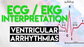 Ventricular Arrhythmias  ECG EKG Interpretation Part 5 [upl. by Enetsirk]